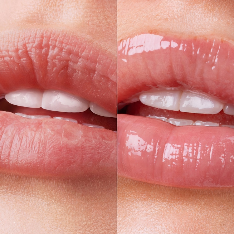 Lip Therapy Glaze Duo - Lippenpflegeset