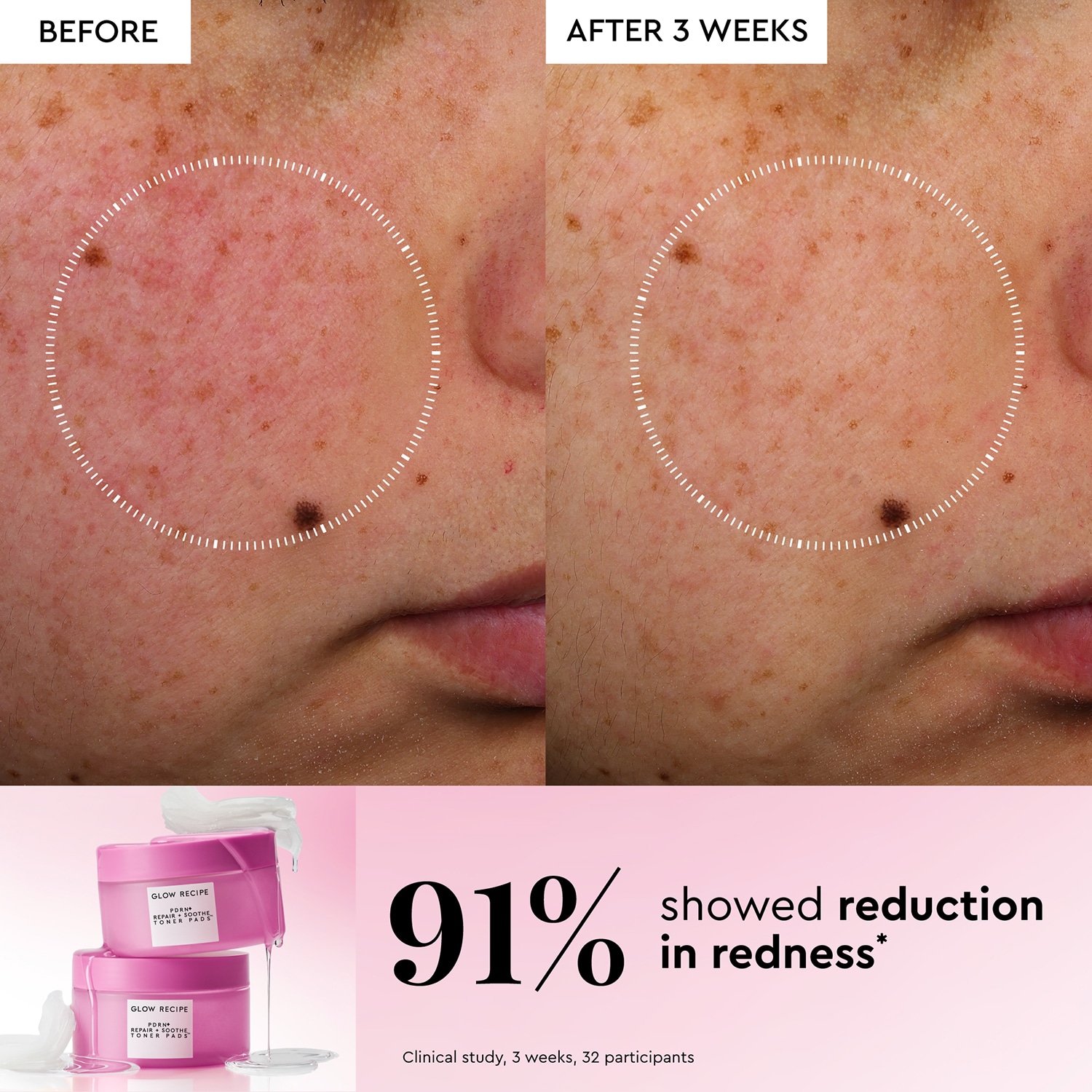 PDRN+ Repair + Soothe Korean Toner Pads for Skin Barrier Repair