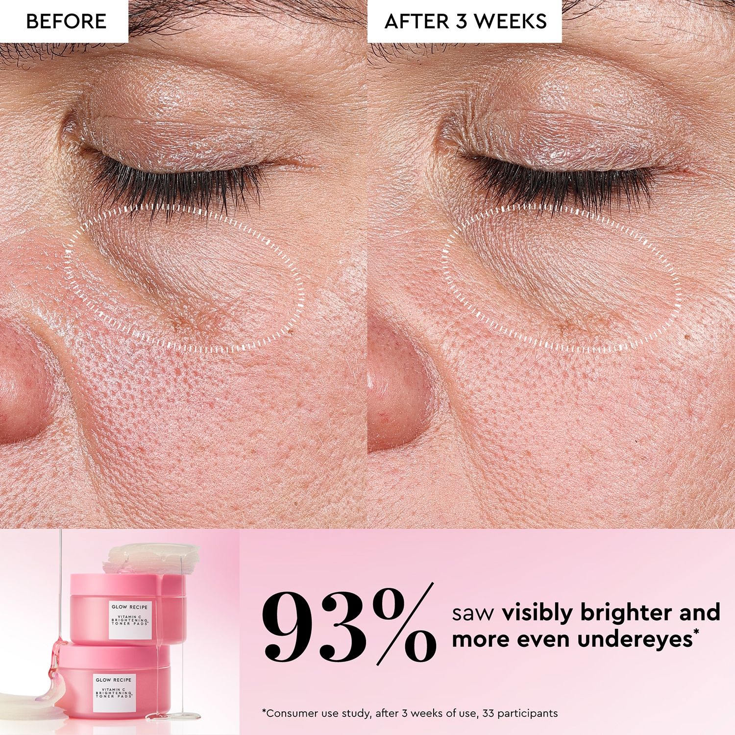Vitamin C Brightening Korean Toner Pads for Undereye & Cheeks