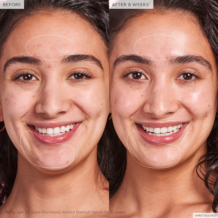 Blackberry Retinol - Återställande serum