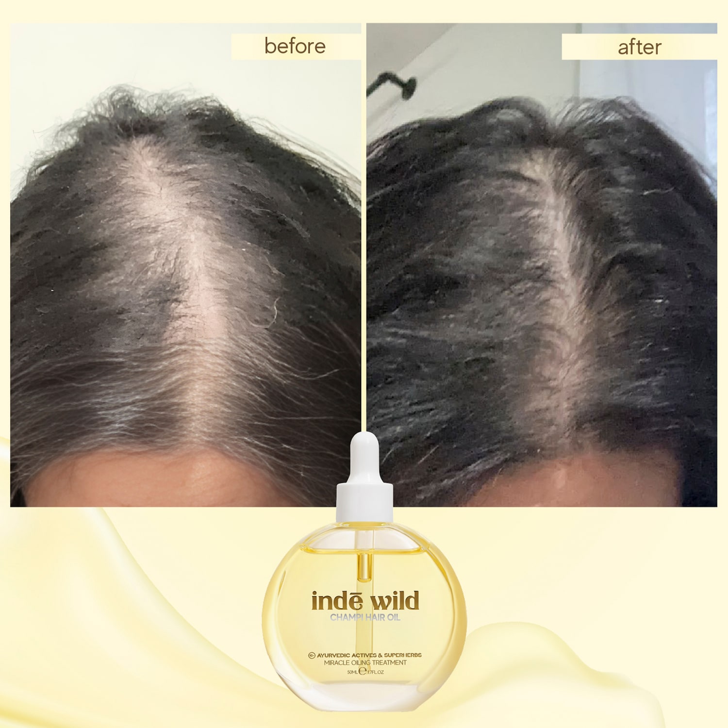 Champi Hair Oil