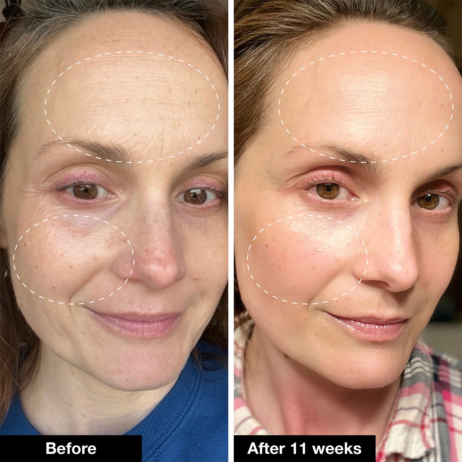 Retinol Remix 1% Retinol Treatment