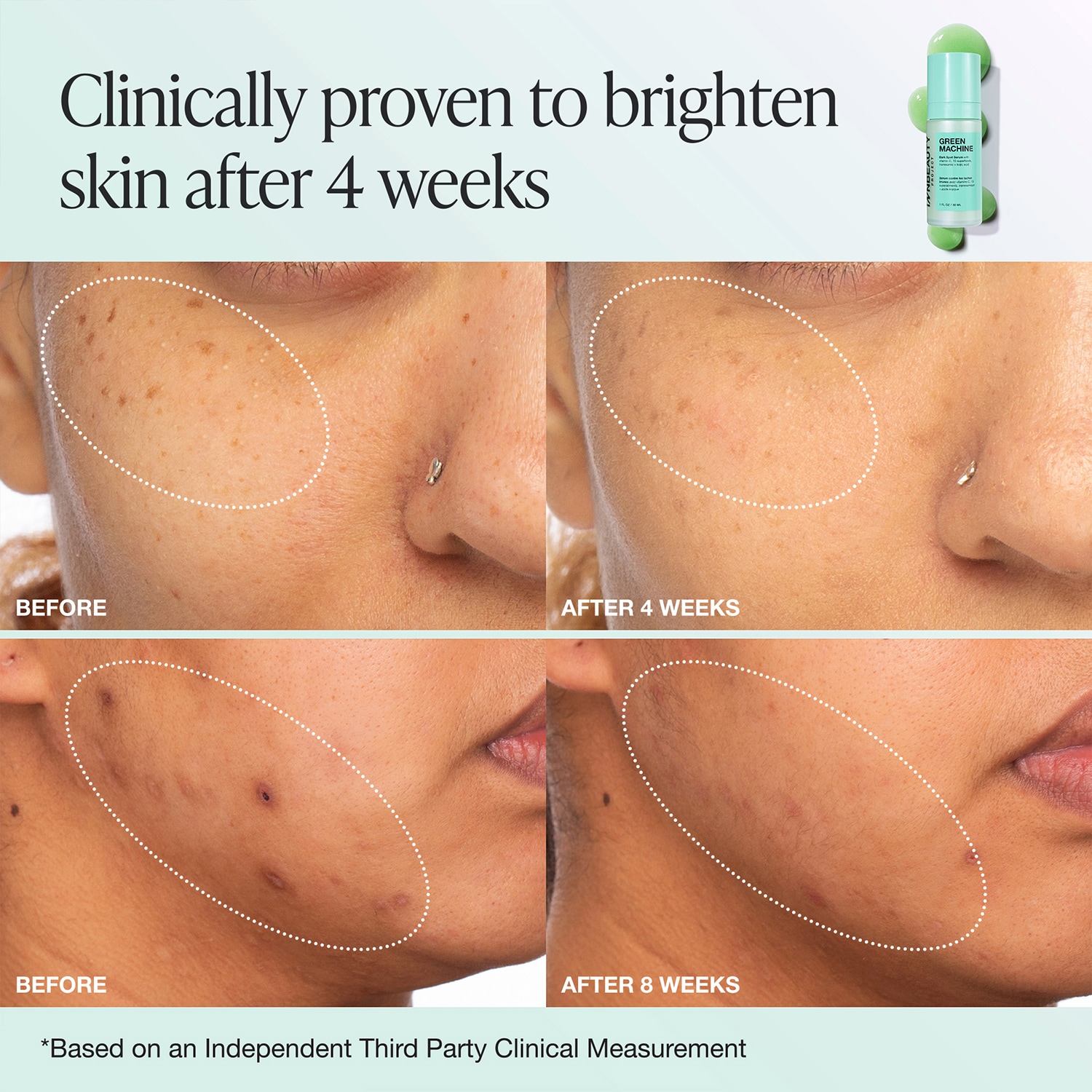 Green Machine Vitamin C Dark Spot & Hyperpigmentation Serum