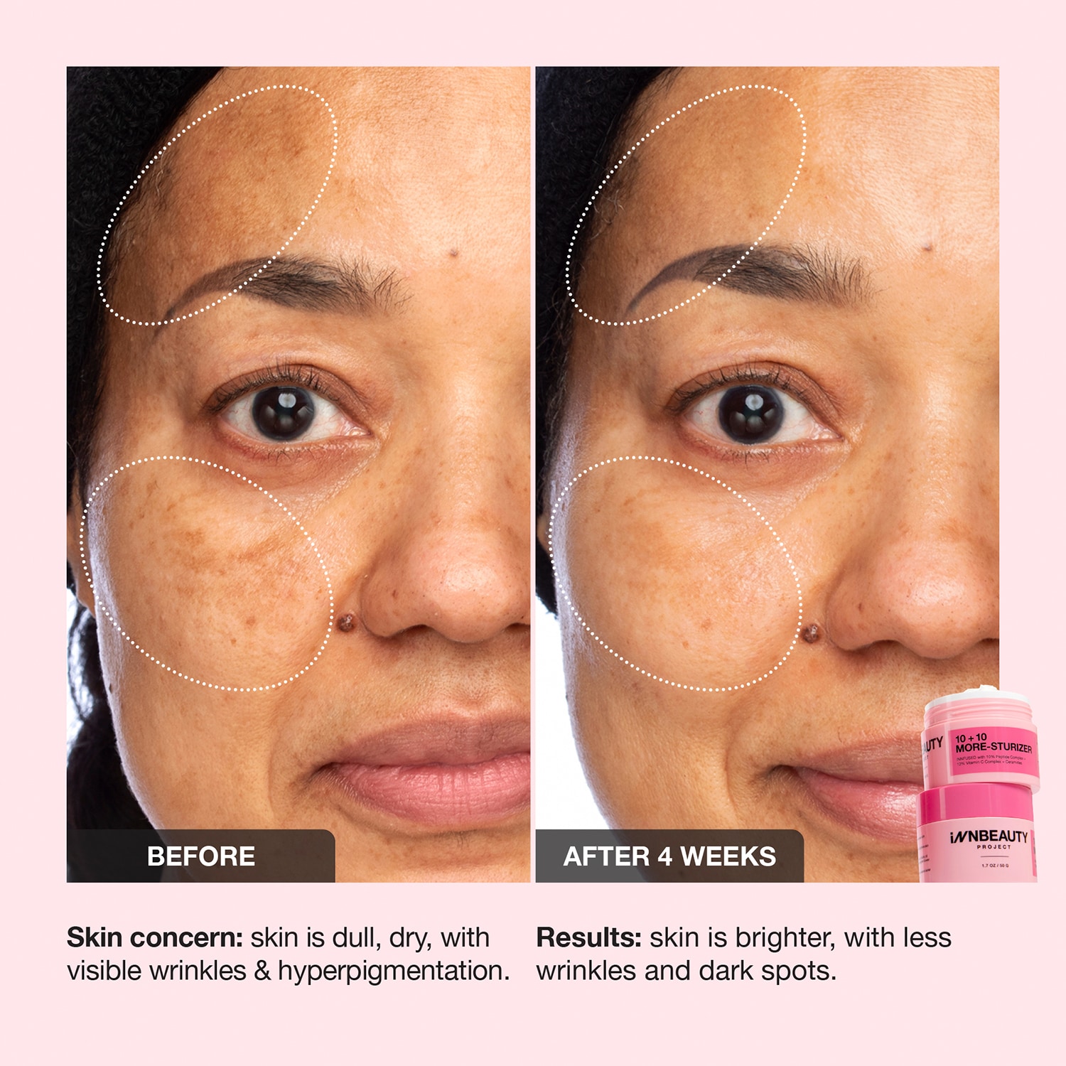 10 + 10 Moisturizer