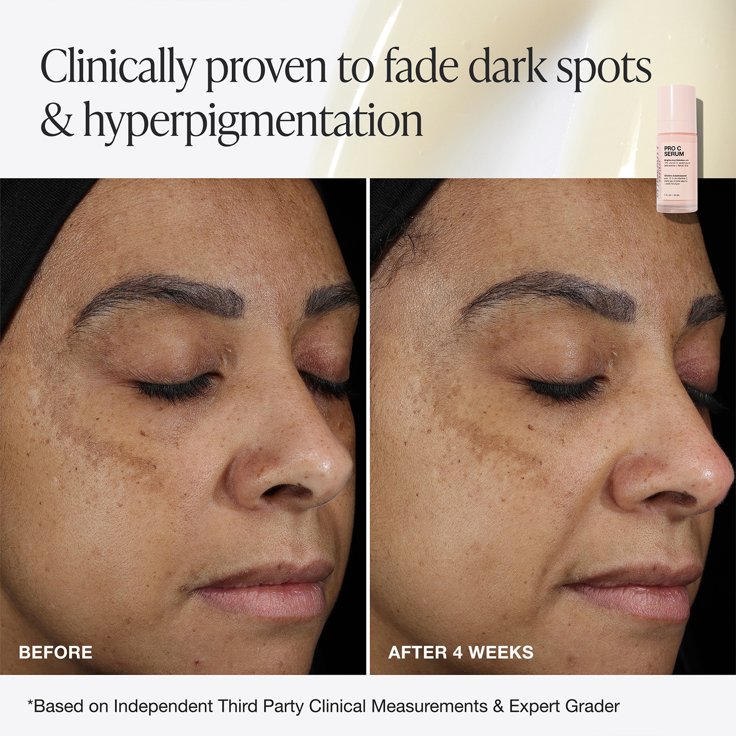 Pro C Brightening & Dark Spot Serum