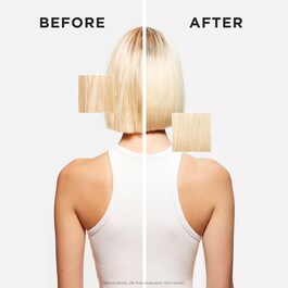 Serum za vlasi&scaron;te i kosu Blond Absolu 2% čiste hijaluronske kiseline