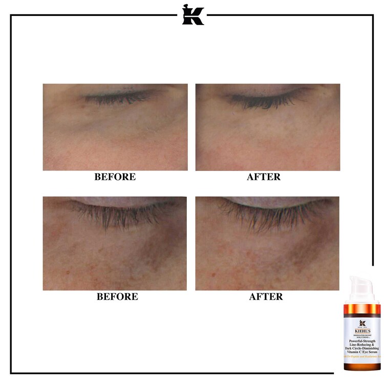 Powerful-Strength Line-Reducing & Dark Circle-Diminishing Vitamin C Eye Serum