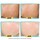Expertly Clear Blemish-Treating & Preventing Lotion - Anti-imperfezioni
