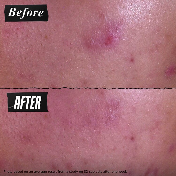 Dermatologist Solutions - Pâte Anti-Imperfections 3-en-1