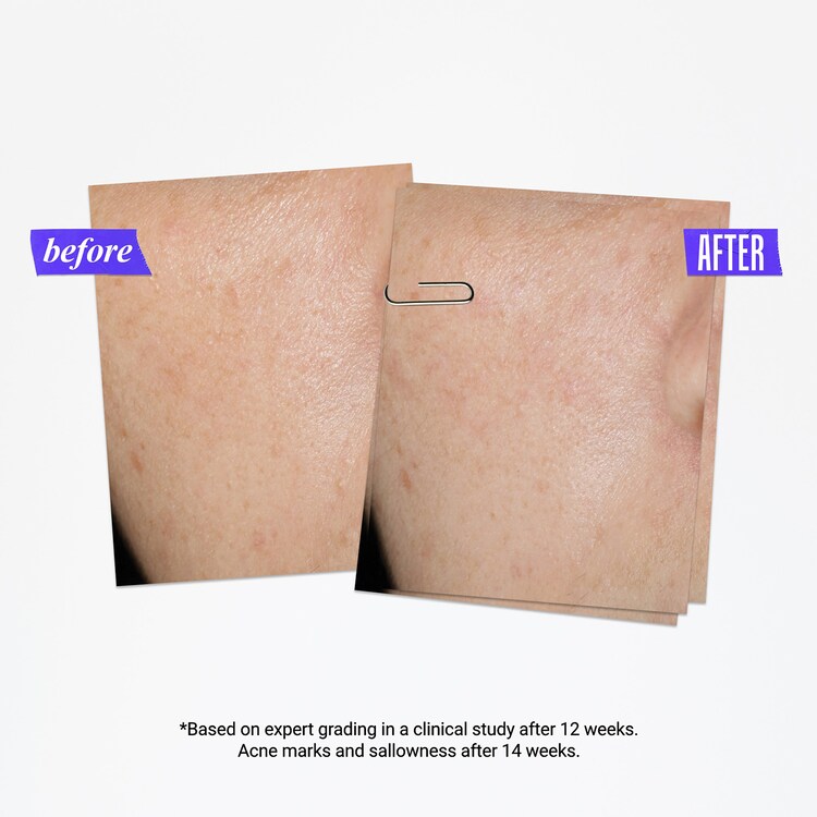 Sérum Anti-Taches à l'Acide Salicylique - Clearly Corrective™ Dark Spot Solution