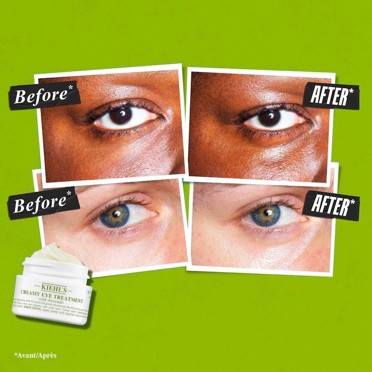 Creamy Eye Treatment With Avocado - Augencreme