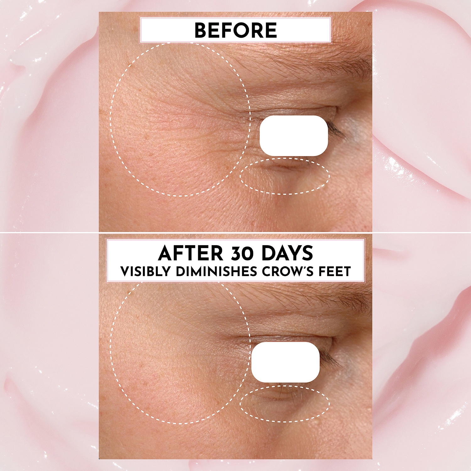 Forget the Filler Skin-Plumping Line-Smoothing Moisturizer 50g