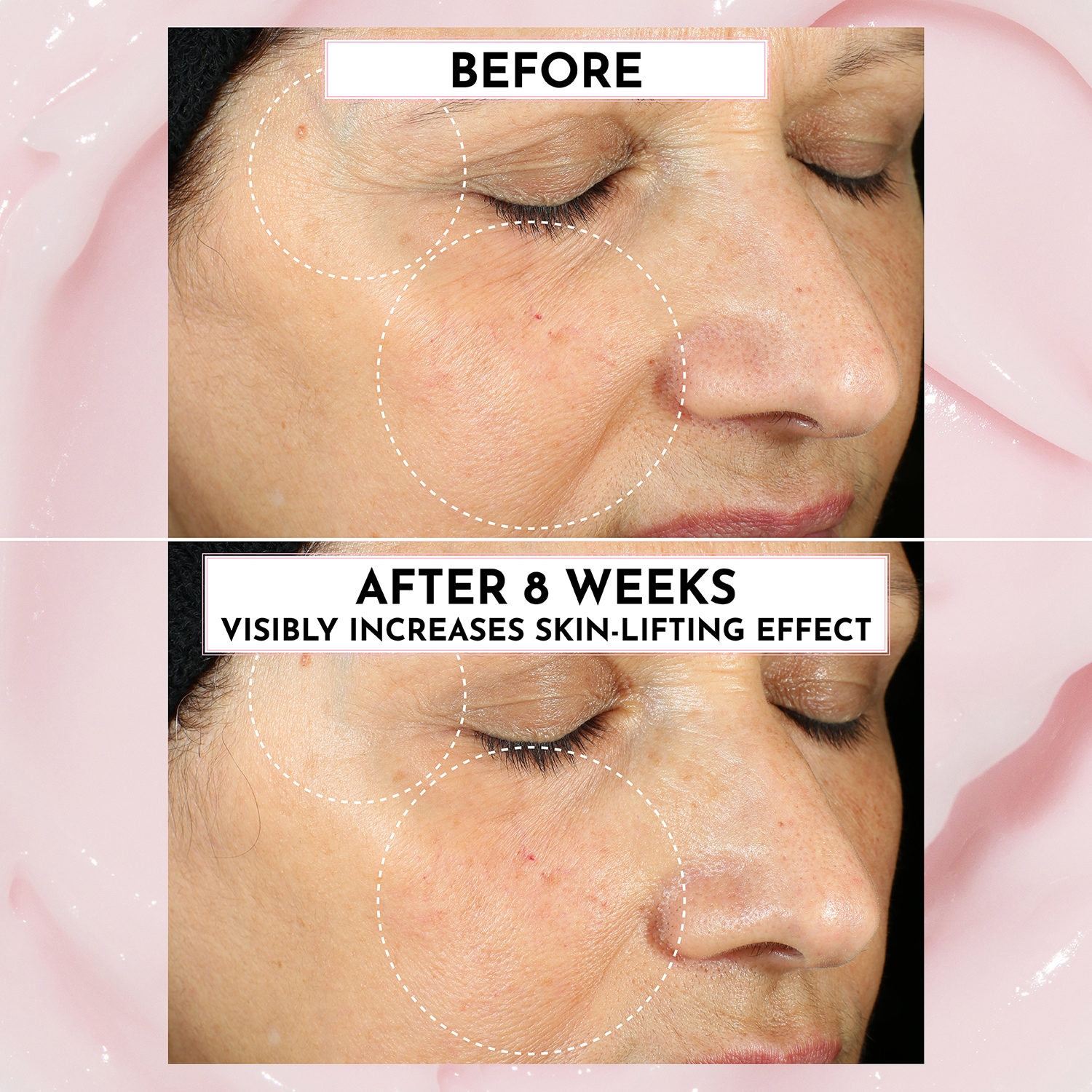 Forget the Filler Skin-Plumping Line-Smoothing Moisturizer 50g