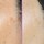 Routine anti-imperfections - Appareil LED et Capsules Spotless
