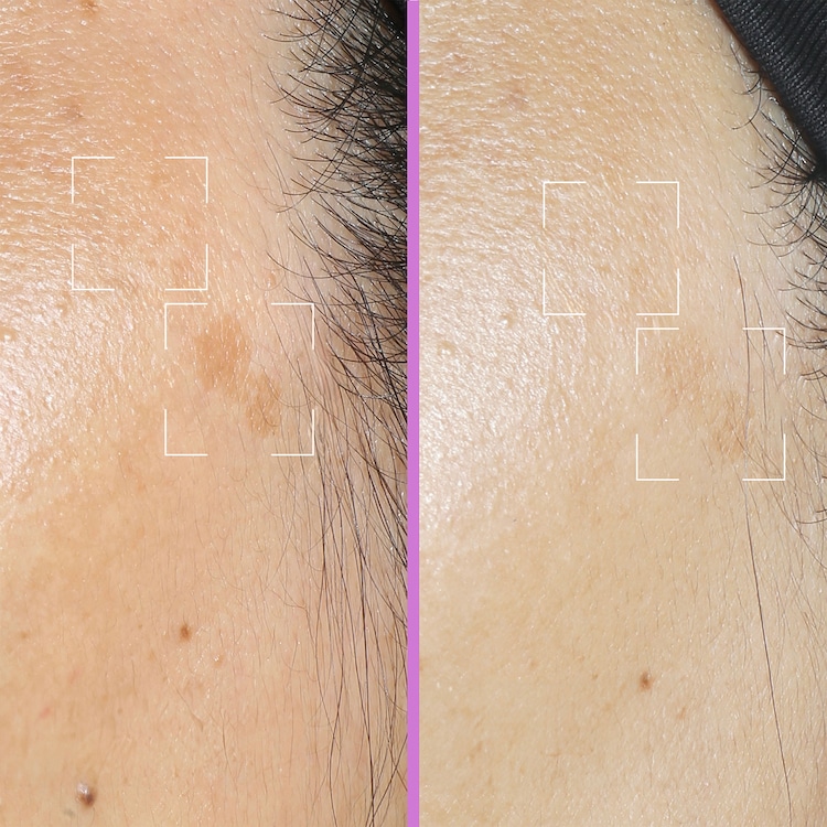 Capsules Spotless - Sérum Correcteur Anti-Taches à la Niacinamide & Réglisse