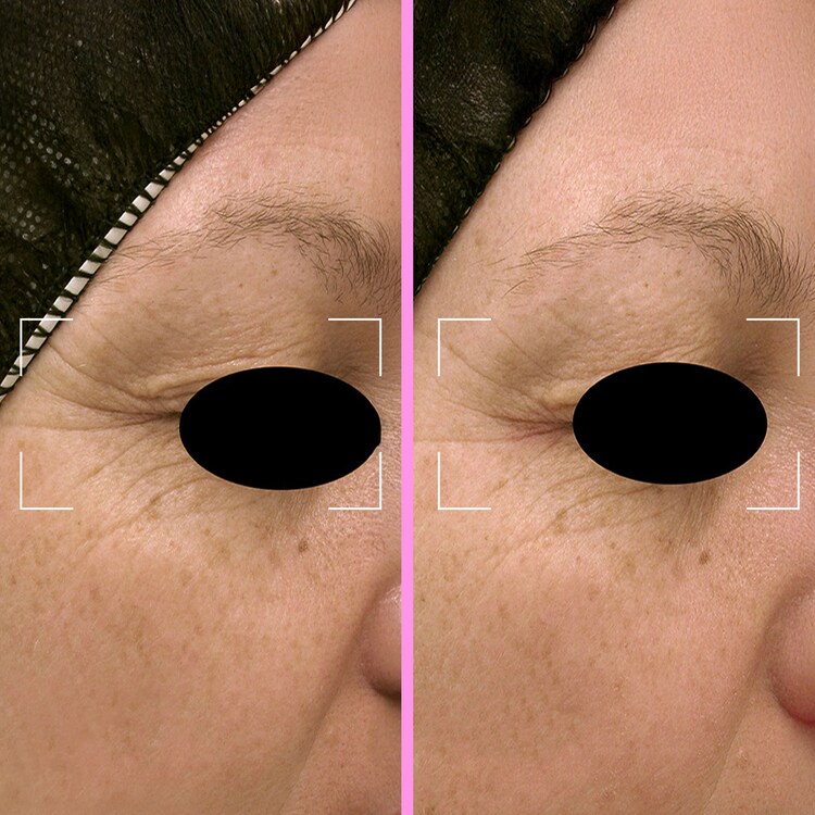 Capsules Repair - Sérum Réparateur Anti-Âge à la Niacinamide & Peptides