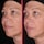 Capsule Lift - Siero rassodante con Niacinamide, Peptide e HA