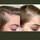 Scalp Care Density Serum - Pflegebehandlung für die Kopfhaut