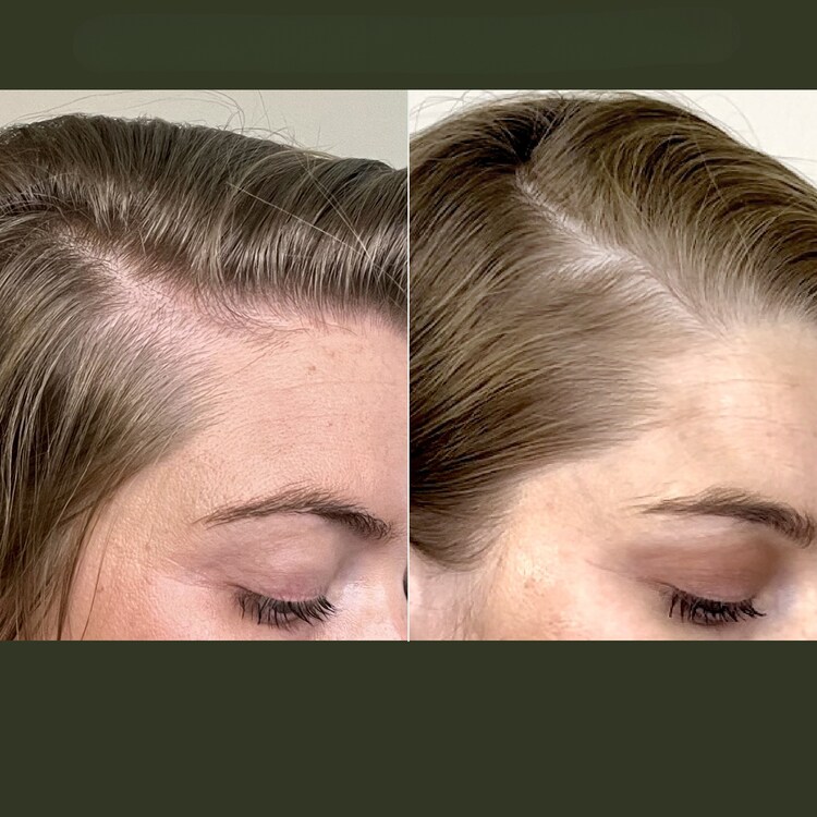 Scalp Care Density Serum - Pflegebehandlung für die Kopfhaut