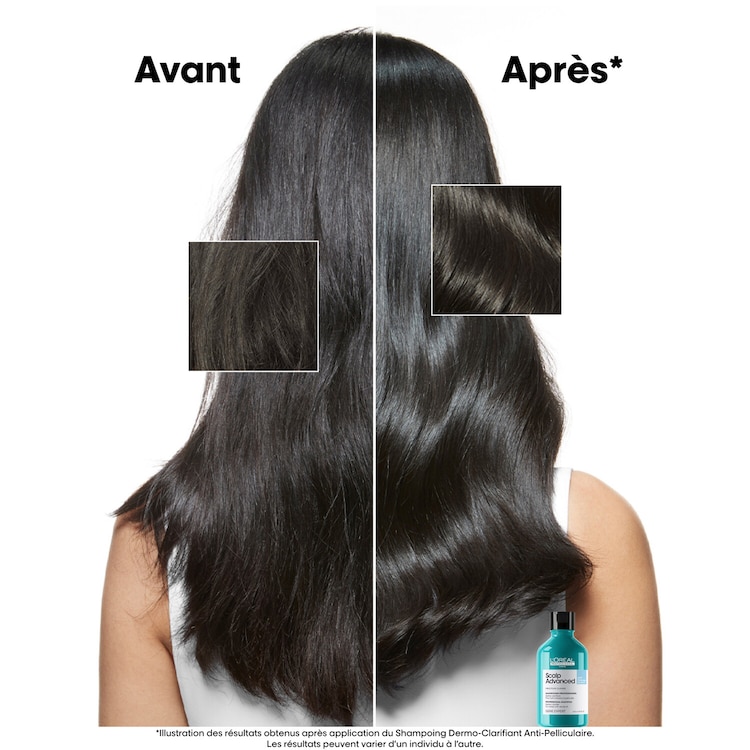Serie Expert Scalp Advanced - Champú anticaspa dermoclarificante