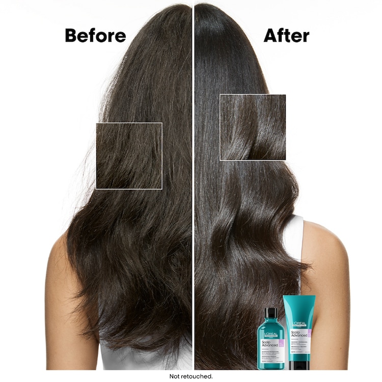 Scalp Advanced - Anti-Discomfort Shampoo