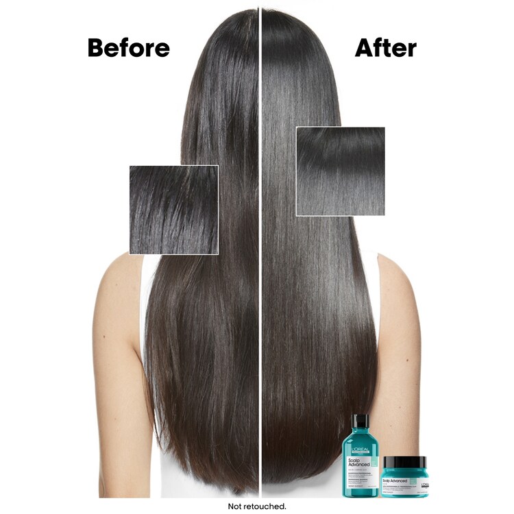 Serie Expert Scalp Advanced - Argile professionnelle shampoing et masque 2-en-1