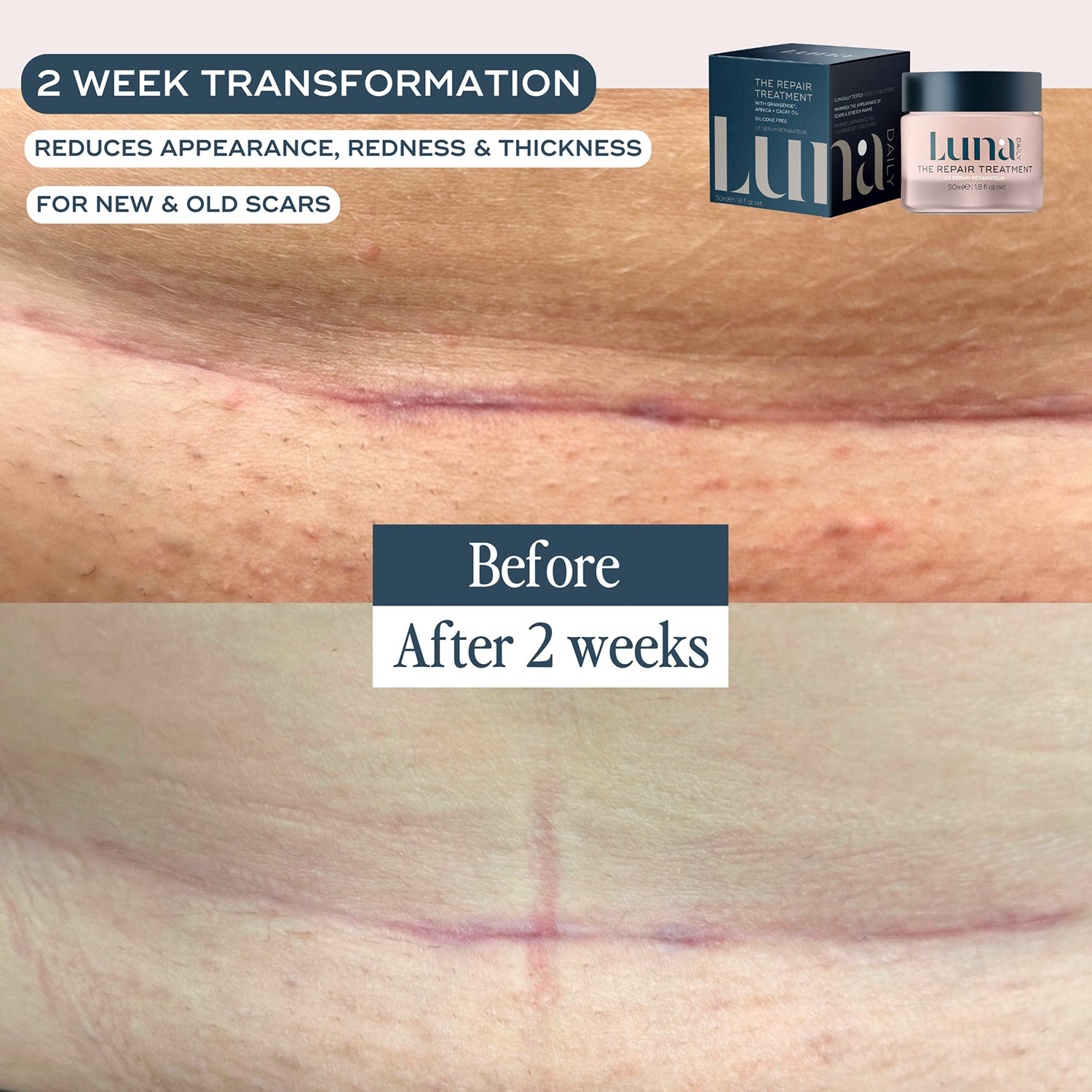 Skin Repair Treatment