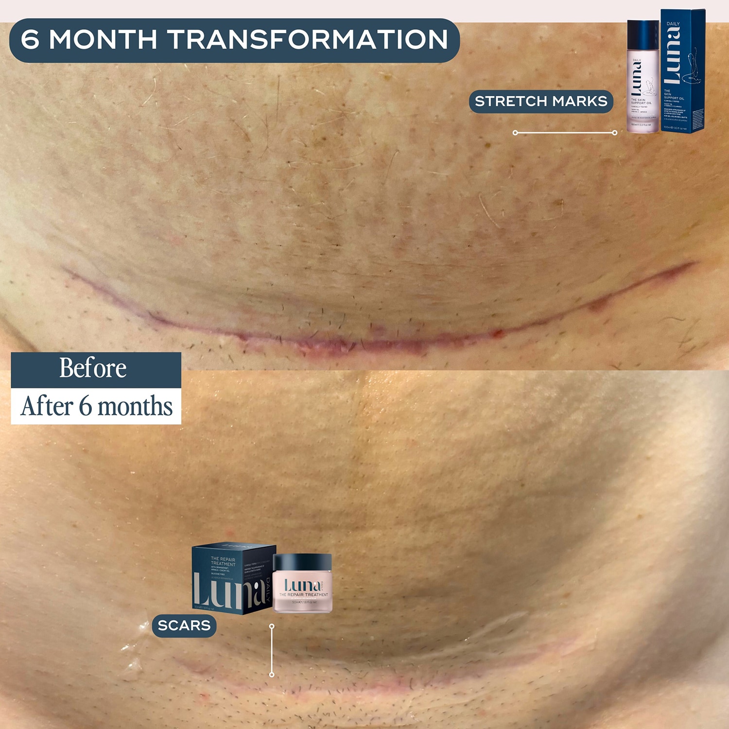 Skin Repair Treatment