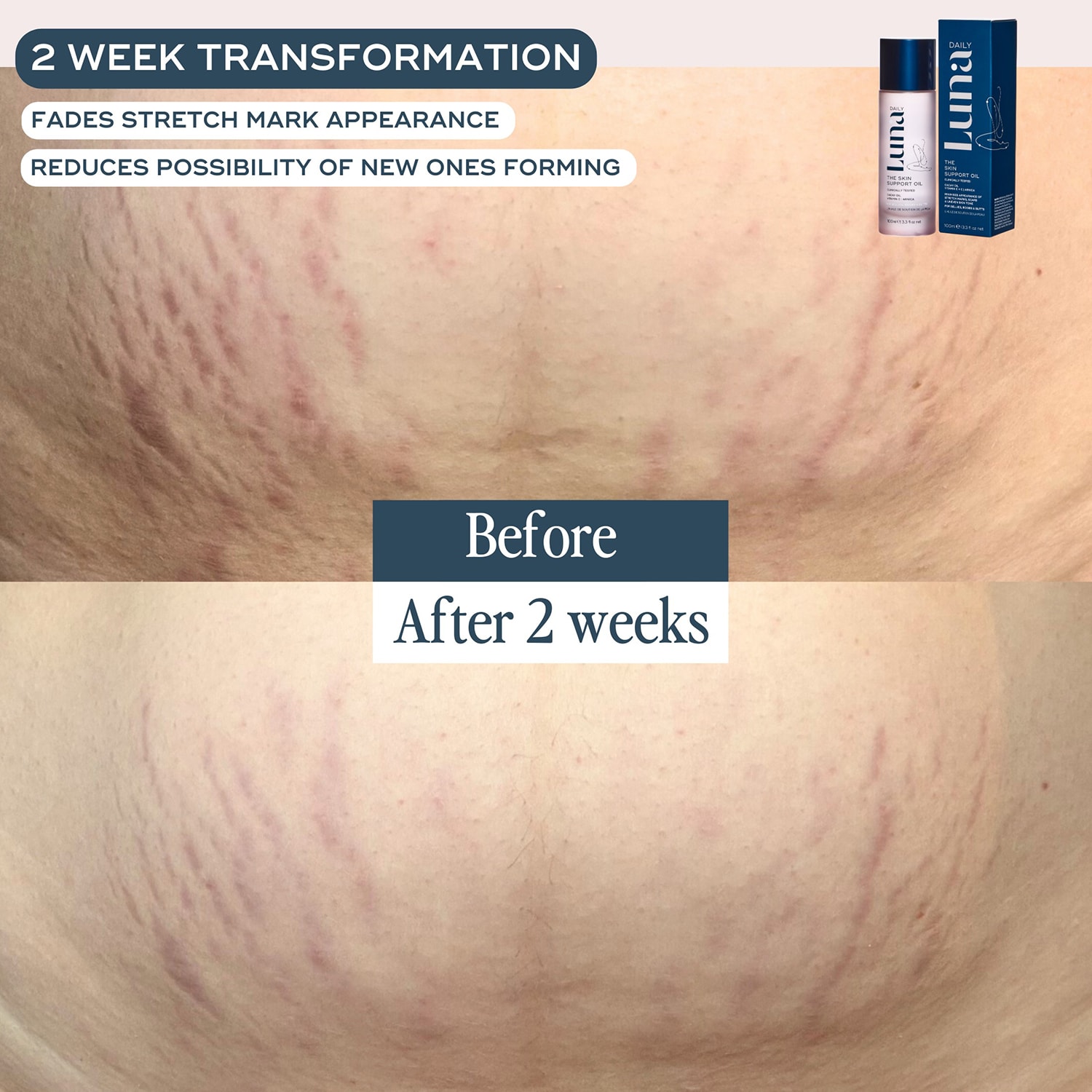 The Skin Support Oil