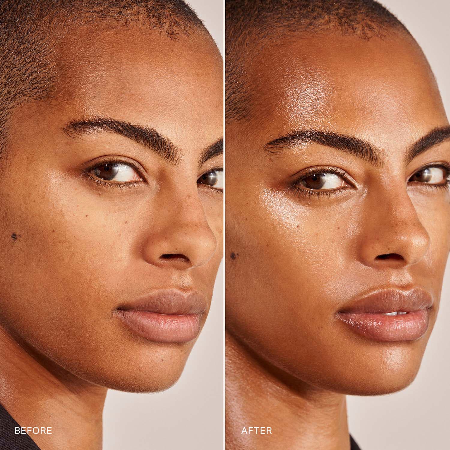Great Skin