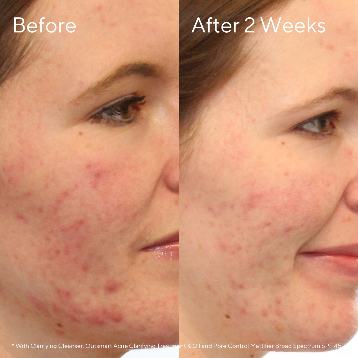 Очищающая пенка для лица Murad Clarifying Cleanser, 200 мл
