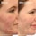 Clarifying Cleanser - Żel oczyszczający do twarzy