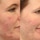 Clarifying Cleanser - Żel oczyszczający do twarzy