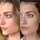 InvisiScar Resurfacing Treatment - Kuracja na blizny potrądzikowe