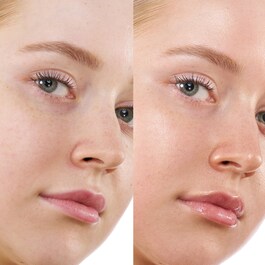 Hy-Gen Bronze Primer Serum -  Bazni serum za lice