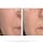 The Professional - LED-Anti-Aging-Gesichtsmaske