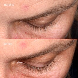Lashbond&trade; - Serum za izgradnju trepavica