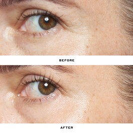 Double Rewind 0,3% serum s retinolom profesionalne kvalitete