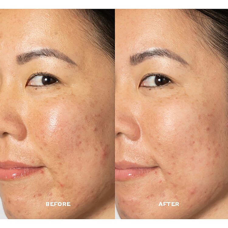 Glow 2OH Dark Spot Toner - Toner do cery z przebarwieniami z kwasami AHA