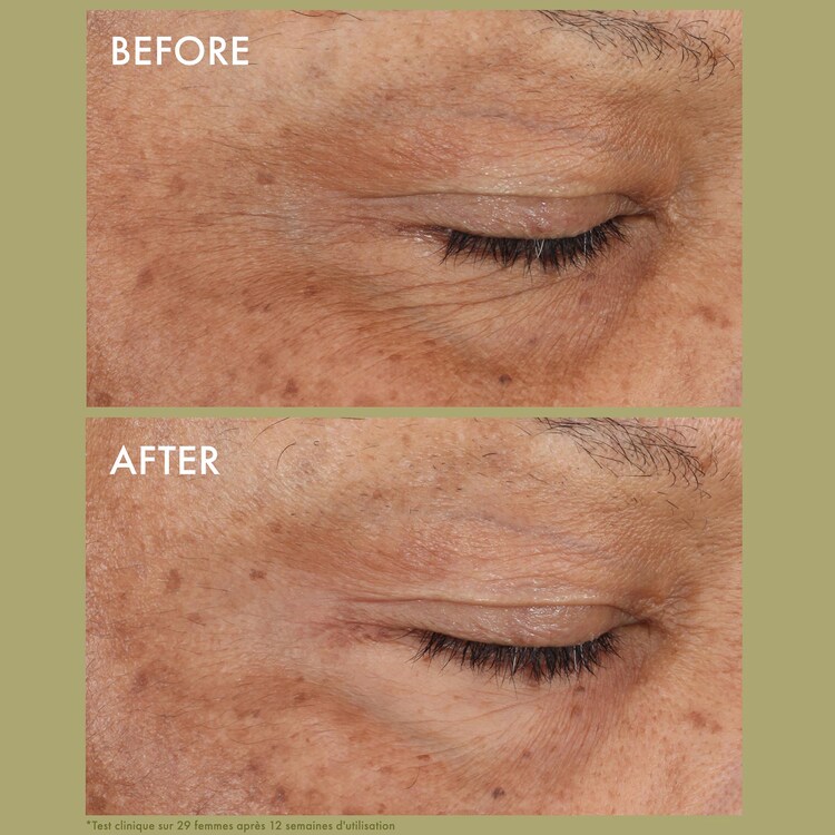 Plantscription™ - Crème Yeux Correction Rides au Rétinol Encapsulé