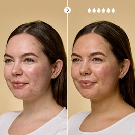 The Impossible Tan&trade; - Hidratantne kapi za samotamnjenje