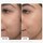 Clinical - Serum duo PRO med retinaldehyd