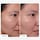 Clinical - Serum z 20% niacynamidu