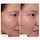 Clinical - Serum 20 % niacinamid