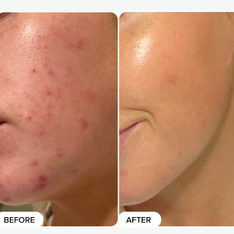 Skin Perfecting - Lotion Exfoliante 2 % BHA Holiday