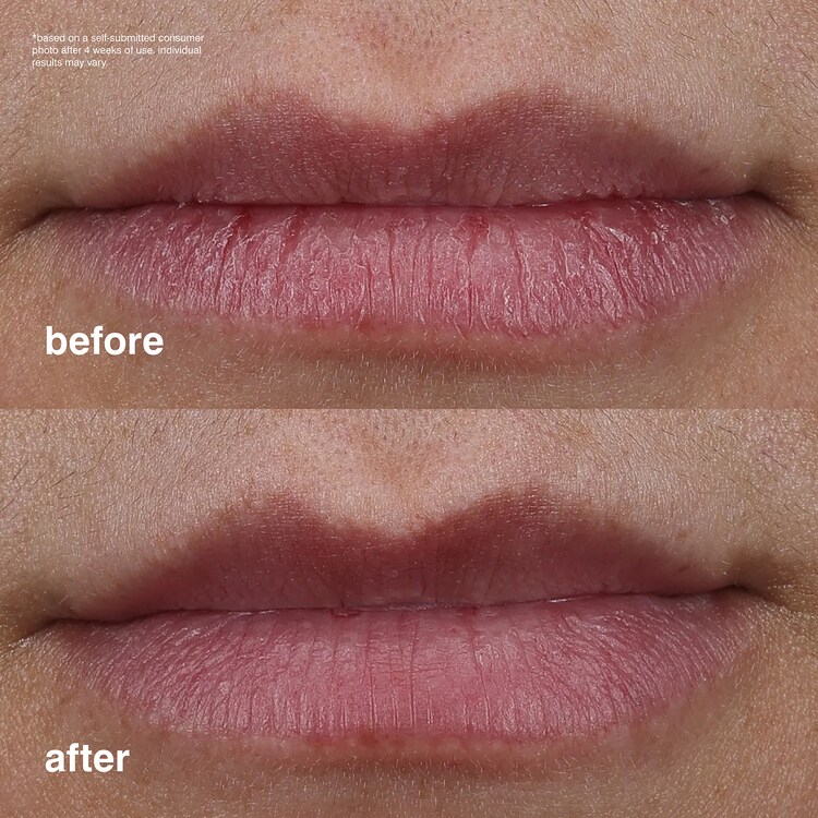 Peptide Lip Treatment -Soin des lèvres nourissant effet glazed