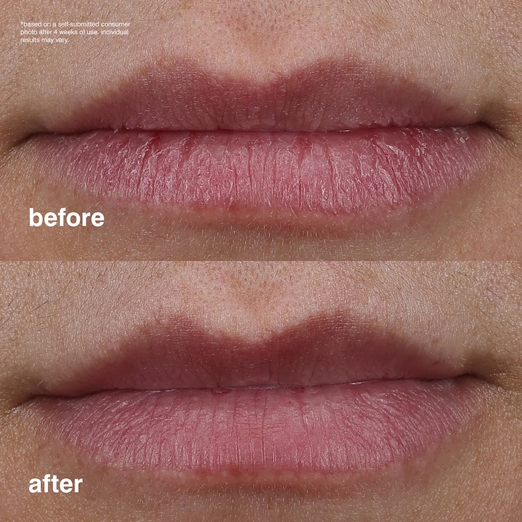 Peptide Lip Treatment - Glaze nutritivo