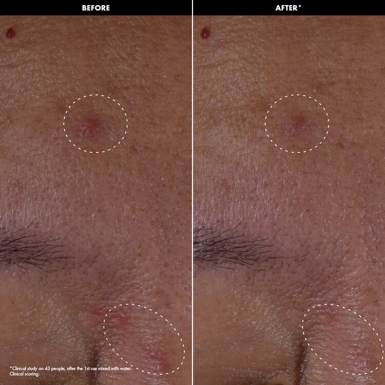 CLEAR & PURIFY - Pudra tratament anti-imperfectiuni cu acid mandelic + ectoina
