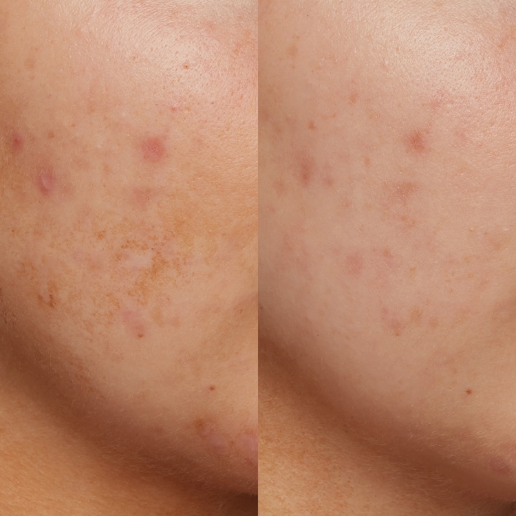 B3 Nice 10% Niacinamide - Ser pentru ten