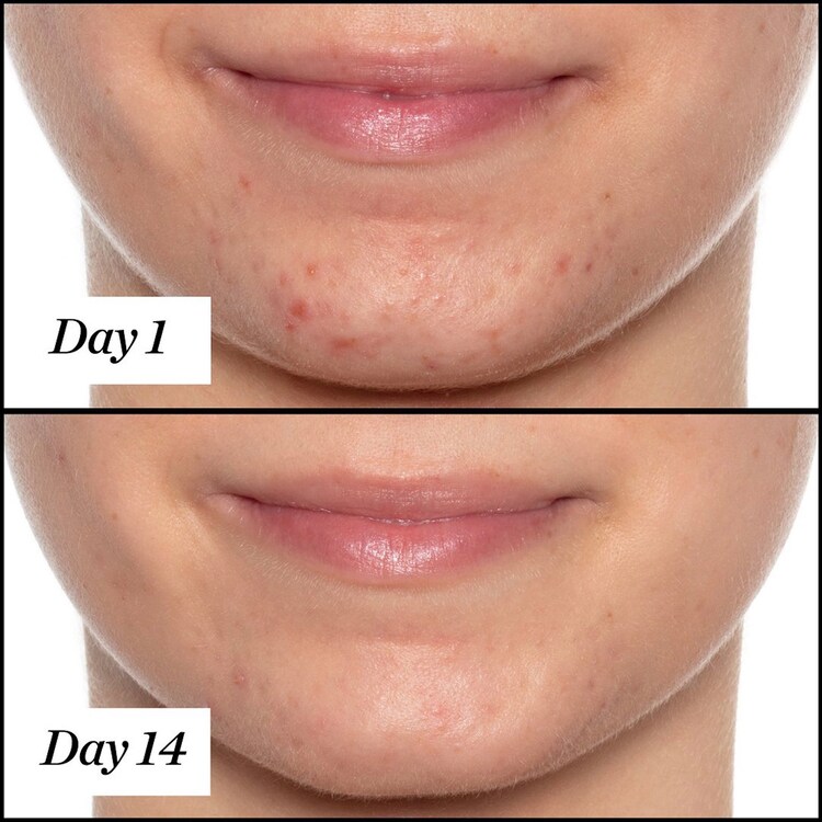 U.F.O. Ultra-Clarifying - Face Oil